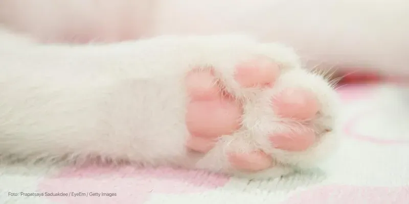 Cãibras nas pernas são perigosas?