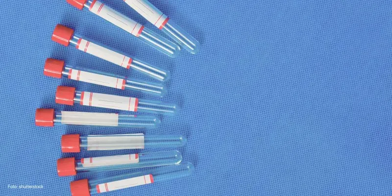 Testes para infecções durante a gravidez