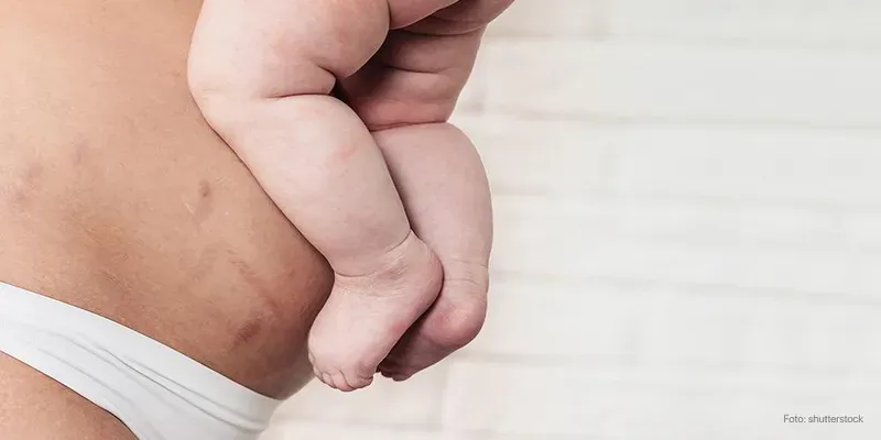 Vida depois do parto: como aceitar seu novo corpo?