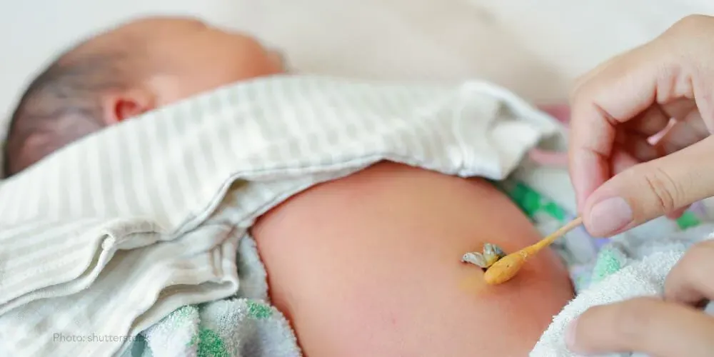 How to care for the umbilical stump