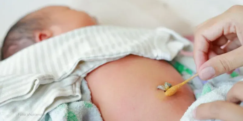 Como cuidar do coto umbilical