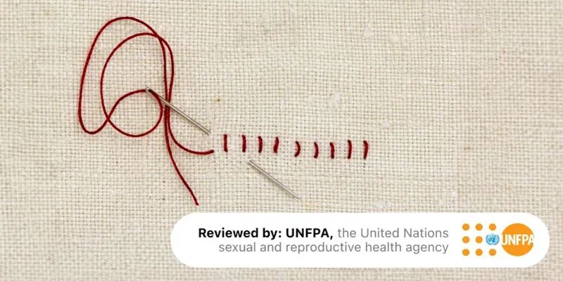 Healing of the perineum