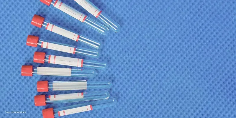 Prueba de infecciones durante el embarazo