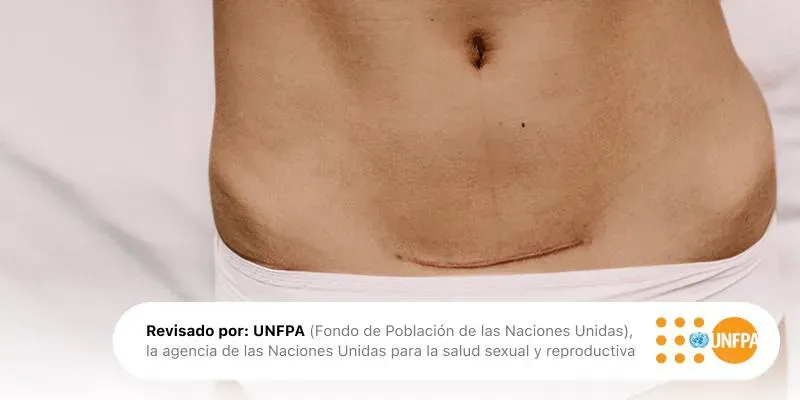 Tener una cesárea no le quita nada a tu maternidad