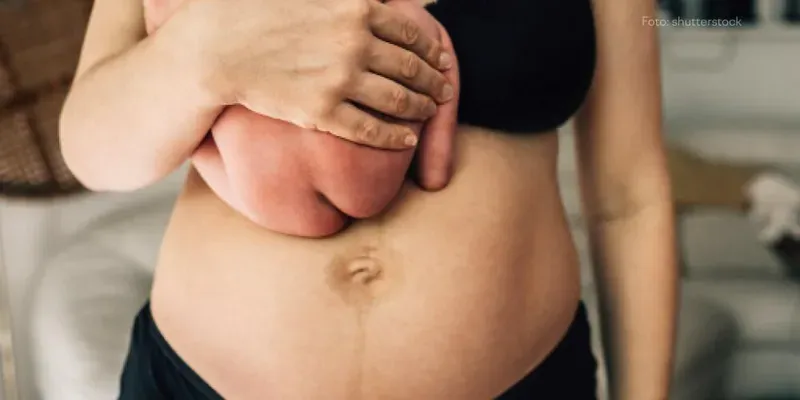 Como perder a barriga após o nascimento do bebê