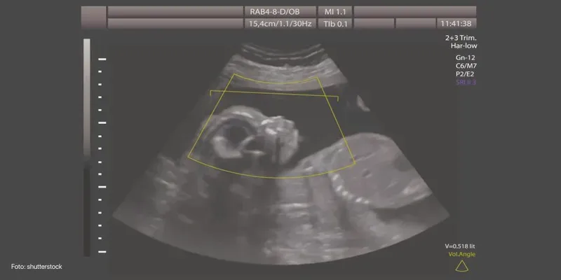 Edad gestacional y datos ecográficos