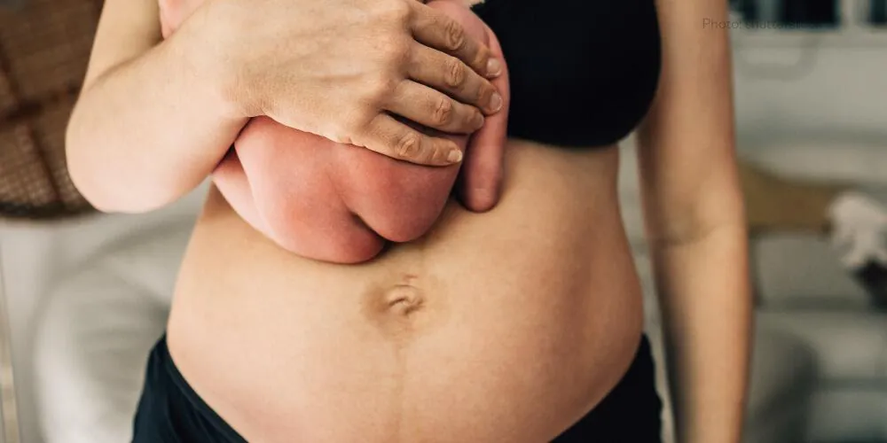 When Does Baby Bump Disappear After Birth? [2024 Guide]